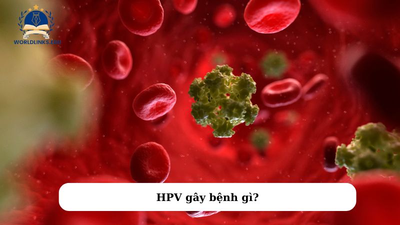 HPV gây bệnh gì?